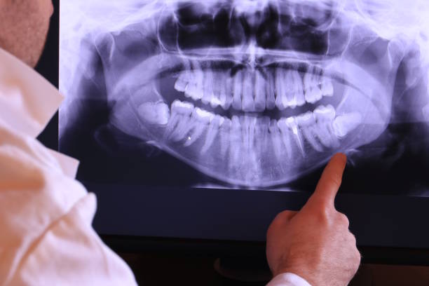 Best Dentist for Tooth Abscess  in Muse, PA